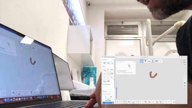 MEDIT i700w Intraoral Scanner with MAC vs WINDOWS Laptop смотреть онлайн