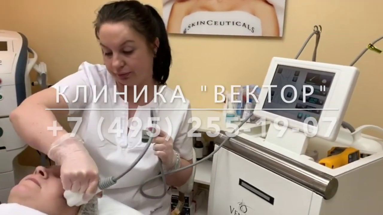 RF-лифтинг на аппарате Venus Freeze смотреть онлайн