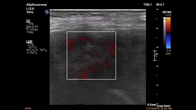 Брюшная полость и малый таз смотреть онлайн