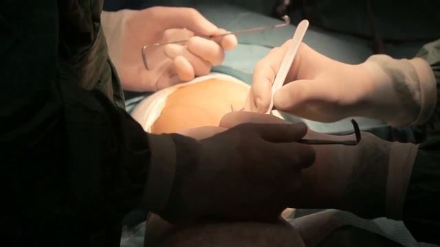 Остеосинтез ладьевидной кости с применением аутотрансплантата костной ткани на сосудистой ножке смотреть онлайн