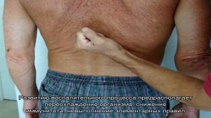 Кровь в моче у мужчин