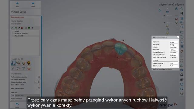 3Shape Clear Aligner Studio - Demo of 3shape Virtual Sub-setup for Clear Aligners PL смотреть онлайн