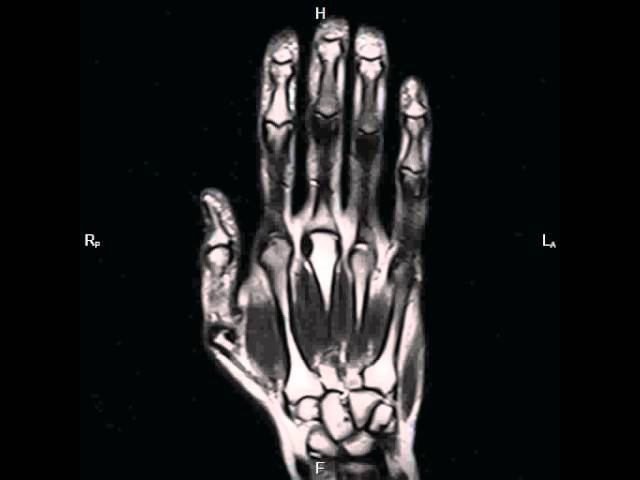 Кисть смотреть онлайн