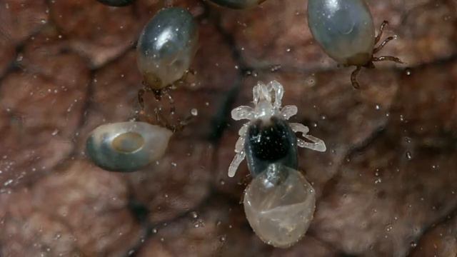 Parasite Case of the Week 472 смотреть онлайн
