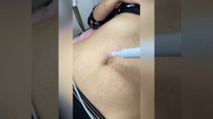 Холодная плазма  Обучение