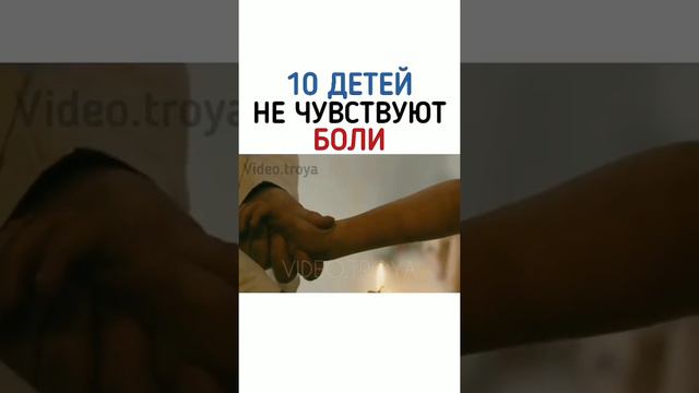 10 детей не чувствуют боли