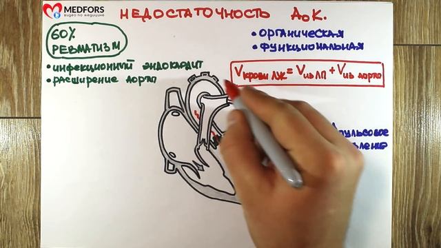 Аортальная недостаточность - "Просто о сложном" смотреть онлайн