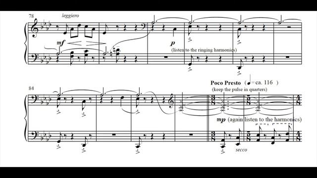 Philip Lasser - The Bruegel Suite Mvt. 2 Peasant Dance смотреть онлайн