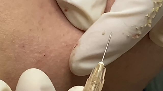 Relax Every Day With Linh Mun Spa #8 смотреть онлайн