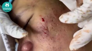 Enjoy Your Day with HANA Spa - Clinic #30