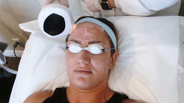 Lumecca Treatment