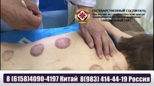 Процедура иглоукалывания в госпитале ТКМ в Китае Далянь