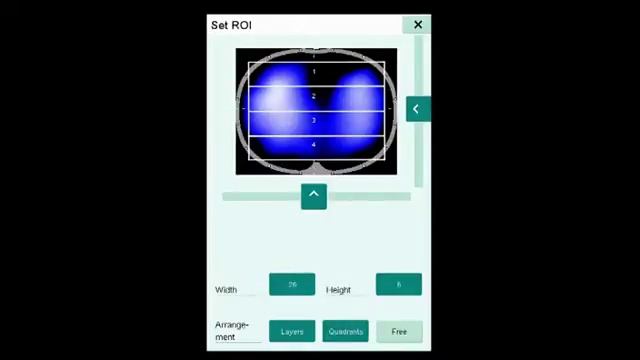 PulmoVista® 500 Haciendo visible la ventilación Introduccion смотреть онлайн