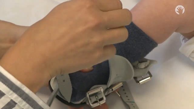 Clubfoot Stretches | Ponseti Brace | Module 4 смотреть онлайн