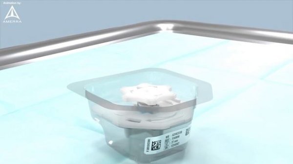 Mitral valve replacement technology - 3D animation