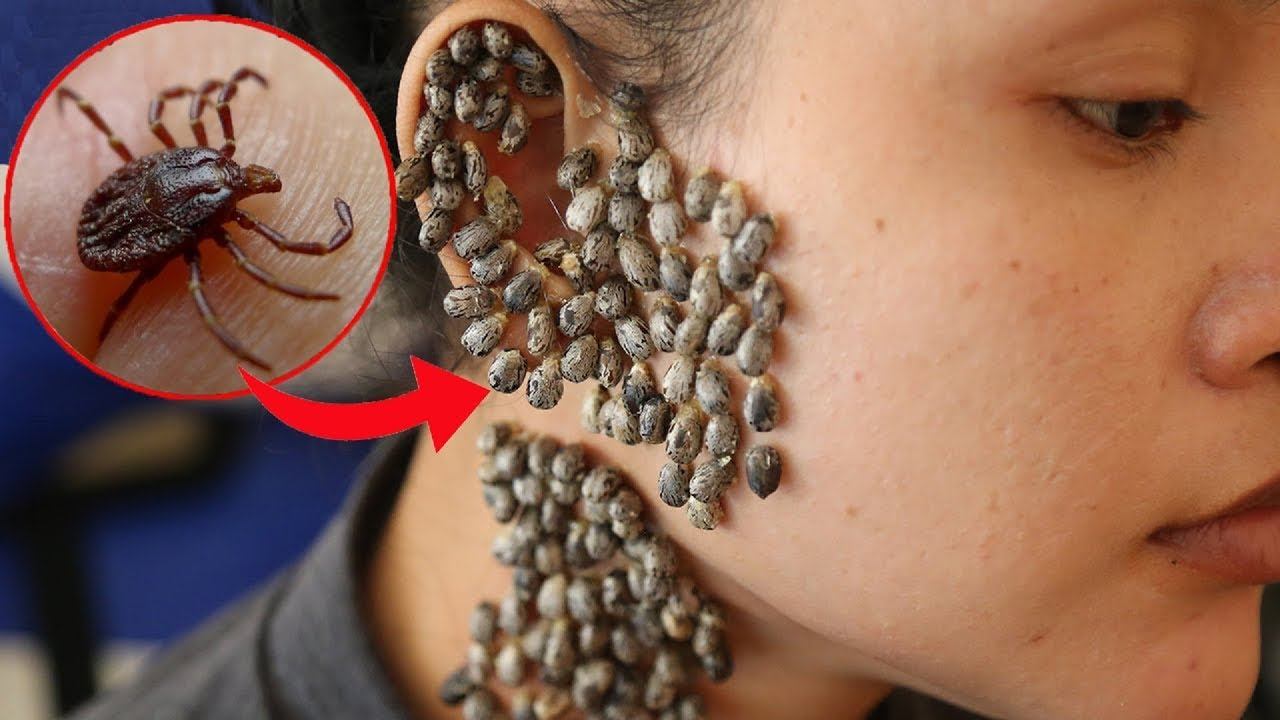 Опасные Насекомые, Которых Опасно Трогать смотреть онлайн