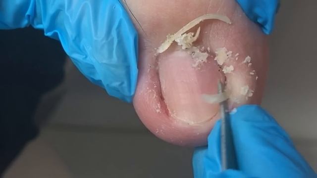 Toenails have dead skin and dirt! Clean up thoroughly【Crazy pedicure room】 смотреть онлайн