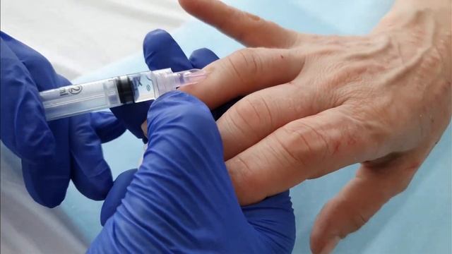 Полинуклеотиды — инновация, омолаживающая кожу изнутри