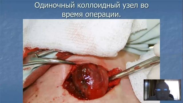 Шитовидная железа 2 смотреть онлайн