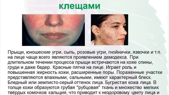 Доктор Малютина. Профилактика старения кожи лица и волос. смотреть онлайн