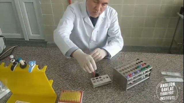 Leykositlar miqdorini aniqlash.Normal fiziologiya.Abduraxmonov Avazbek Xoshimovich смотреть онлайн