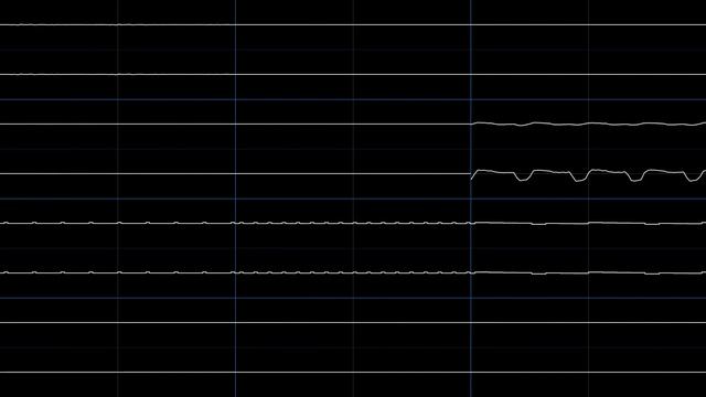 Pokémon Mystery Dungeon: Red Rescue Team - Mt. Thunder (oscilloscope view) смотреть онлайн