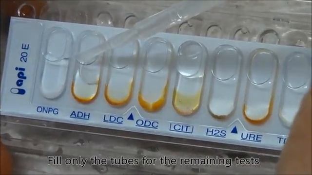 Performing an API 20E strip test смотреть онлайн