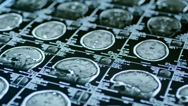 The Bizarre Boltzmann Brain Hypothesis Explained by Brian Greene смотреть онлайн