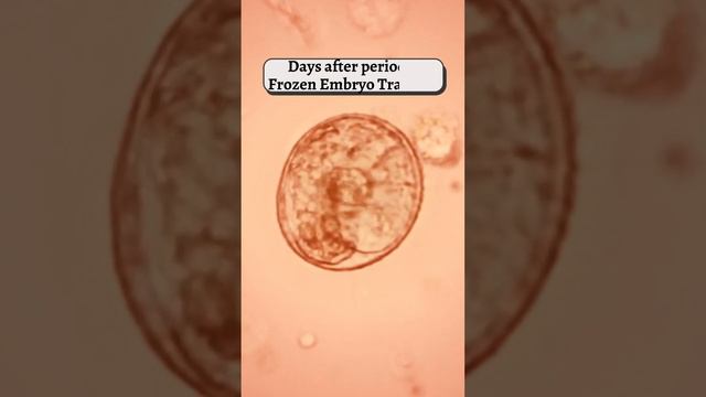 Frozen Embryo Transfer смотреть онлайн