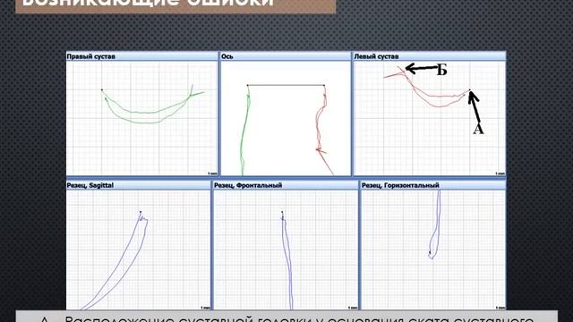 Регистрация артикуляции н/ч смотреть онлайн