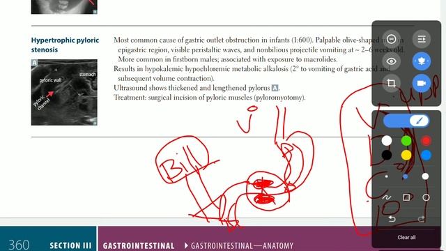 Up To Date - GIT empryology (part 2) смотреть онлайн