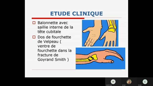 Visioconf - Ortho : traumatisme du poignet. смотреть онлайн