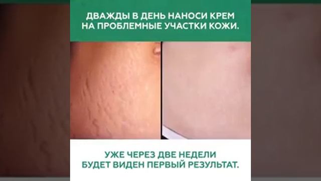 Как отбеливать зубы, как избавиться от морщин в домашних условиях смотреть онлайн
