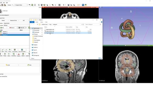 Export Slicer image segmentation to STL or OBJ file смотреть онлайн
