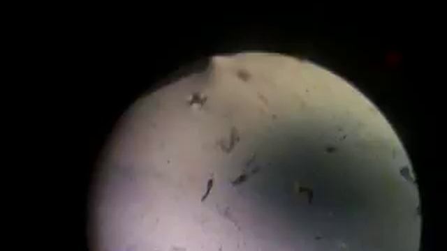 cercaria Fasiolopsis buski and Schistosoma sp. смотреть онлайн