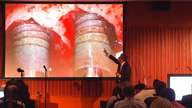 Europerio - Laser dentistry presentation by Dr. Rasperini смотреть онлайн