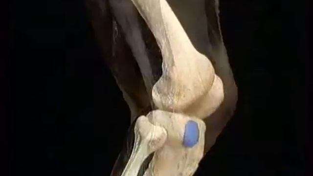 широкая фасция бедра