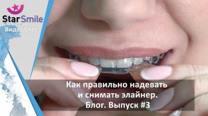 Как правильно надевать и снимать элайнеры для выравнивания прикуса. Видео-инструкция от врача