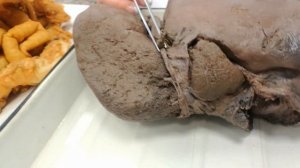 Анатомия | Пищеварительная система - Печень