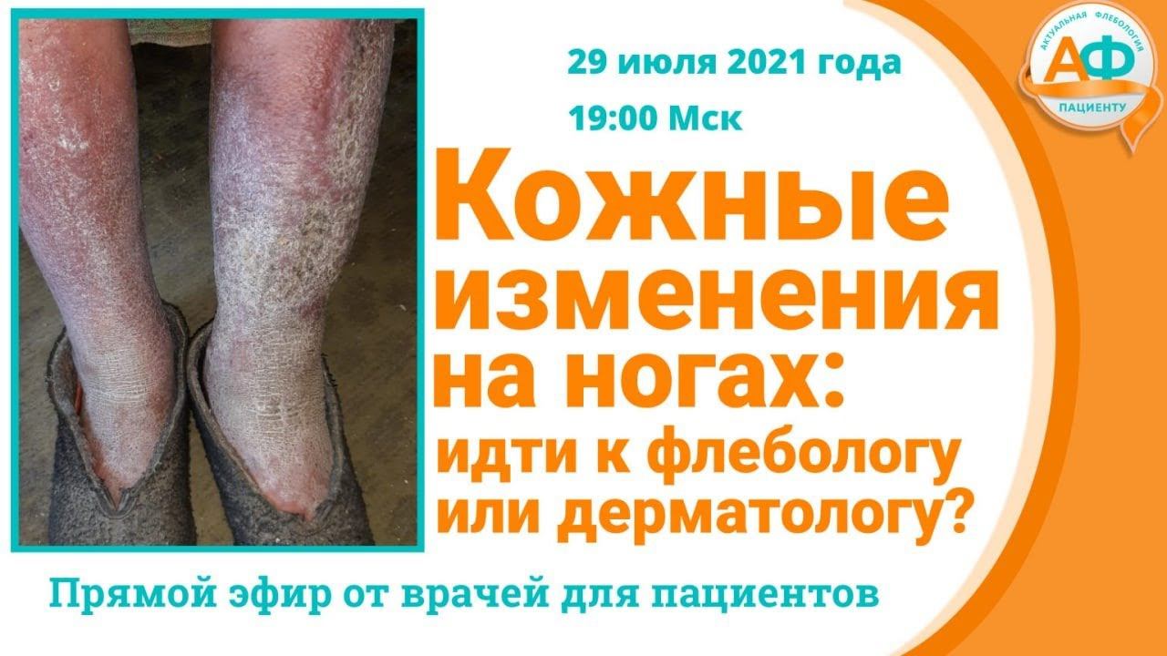 Кожные изменения на ногах: идти к флебологу или дерматологу? смотреть онлайн