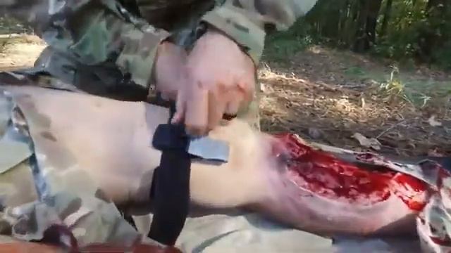 4.1. Переміщення, перекладання турнікета смотреть онлайн