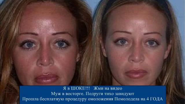 Watch Фотоэпиляция Салон Красоты Мой Стиль - Фотоэпиляция Цены