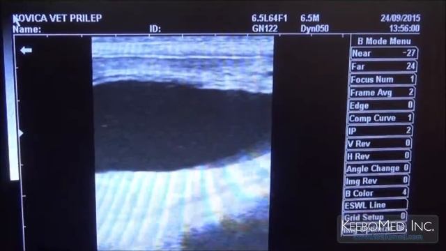 Ultrasound KX500V vs SIUI CTS 800 comparison смотреть онлайн