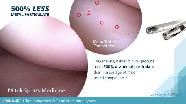 PureVue DePuy Synthes Mitek Sports Medicine смотреть онлайн