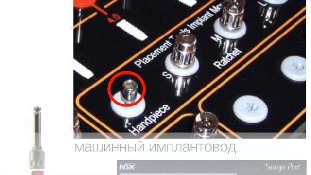 Хирургический протокол установка имплантатов смотреть онлайн