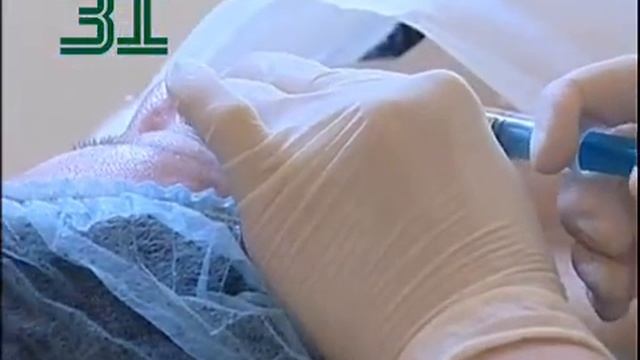 Плазмолифтинг, Plasmolifting