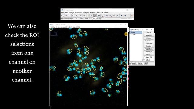 FIJI (ImageJ): Measuring Overlap using the ROI Manager смотреть онлайн