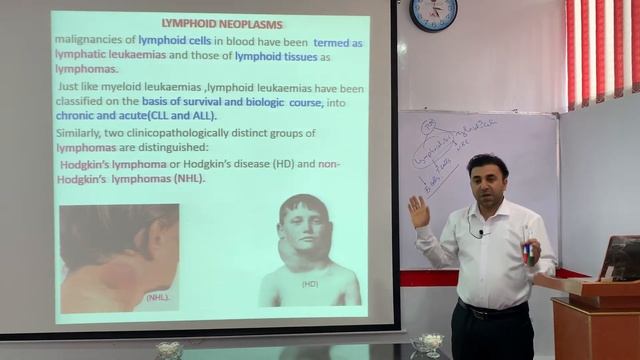 Lymphoid neoplasm General information) د لمفاوی سرطانو په اړه عمومی معلومات смотреть онлайн