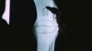 *Кремний - значение для здоровья. Кремния много, доступных форм мало.