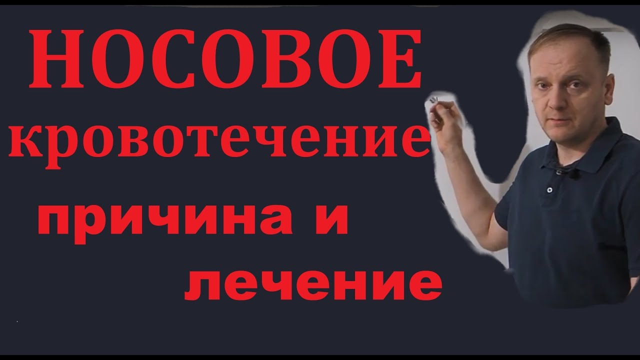 Носовое кровотечение, причина и лечение смотреть онлайн